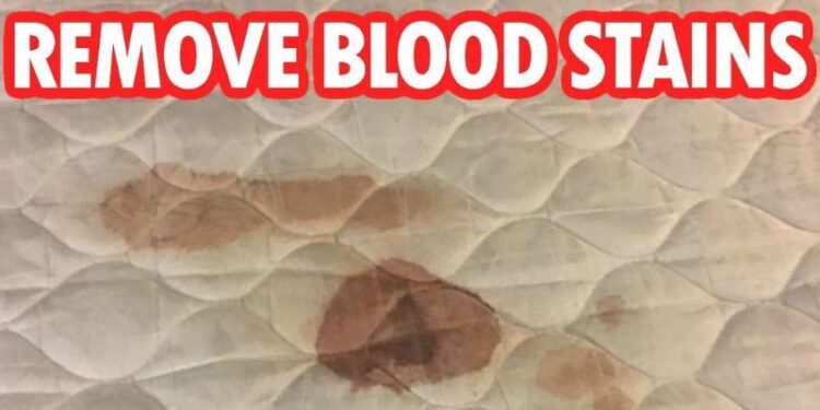 How to Remove Blood Stains From a Mattress?